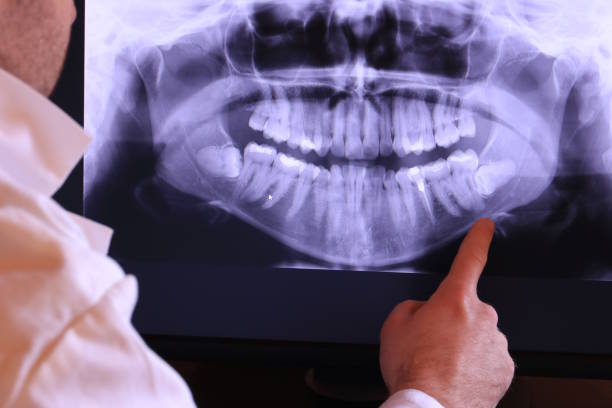 Best Emergency Care for Gum Disease in Melrose Park, NY